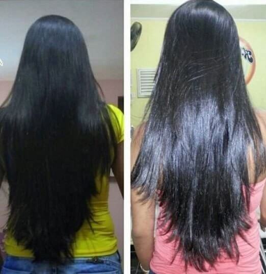 Forever Liss Antes de depois