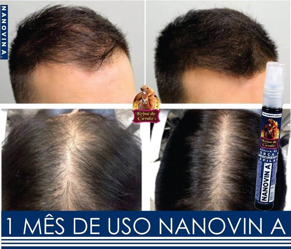 Tônico Nanovin