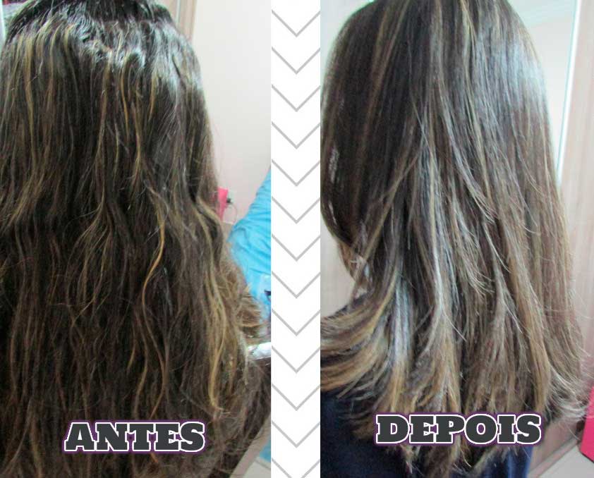 Resultado Antes e Depois Forever Liss